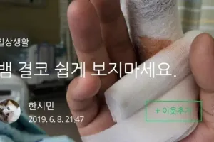 뱀에 물리고 치료한 과정(혐주의)