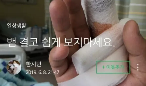 뱀에 물리고 치료한 과정(혐주의)