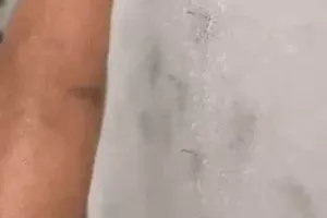 옷을 입어도 모기한테 물리는 이유