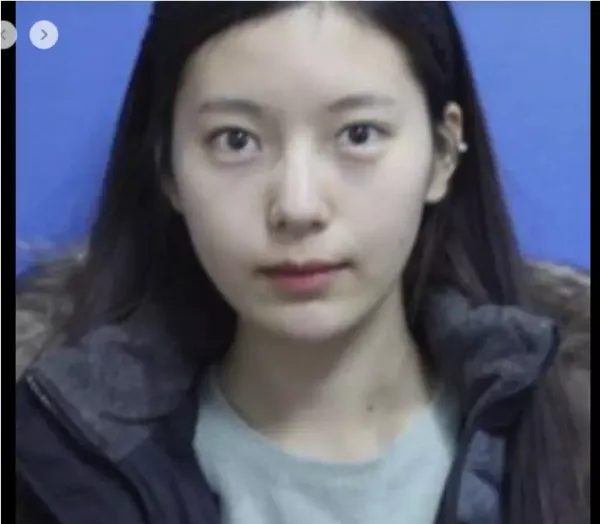 미녀 웹툰 작가 야옹이 성형하기 전