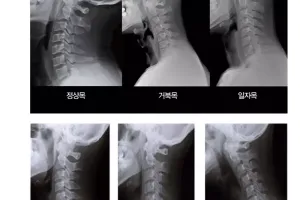 현대인들이 많이 앓는 병