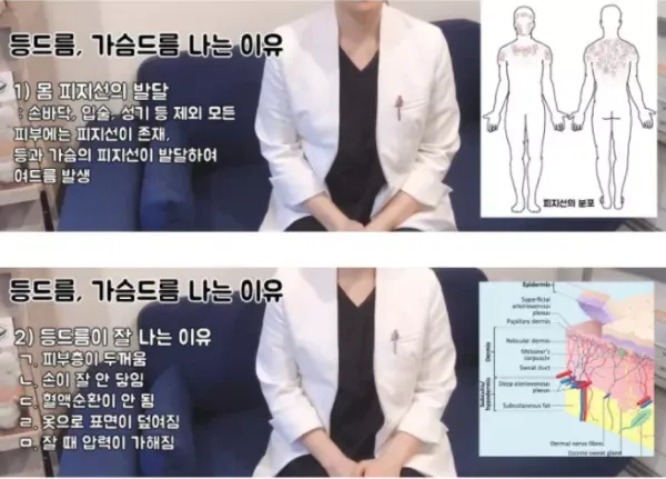 가슴과 등에 여드름이 생기는 이유